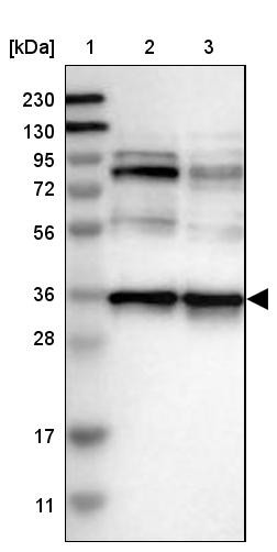 Lane 1: Marker [kDa] 230, 130, 95, 72, 56, 36, 28, 17, 11<br/>Lane 2: Human cell line RT-4<br/>Lane 3: Human cell line U-251MG sp