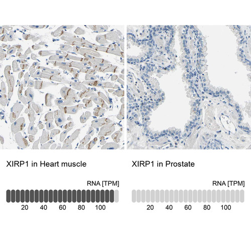 Immunohistochemistry analysis in human heart muscle and prostate tissues using HPA018458 antibody. Corresponding XIRP1 RNA-seq data are presented for the same tissues.