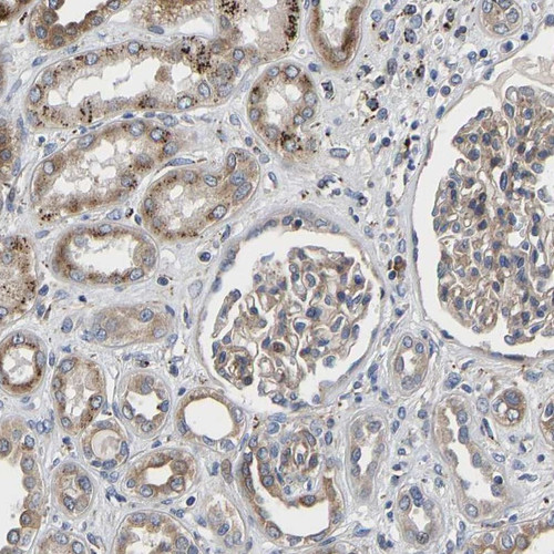 Immunohistochemical staining of human kidney shows moderate cytoplasmic positivity in cells in tubules.