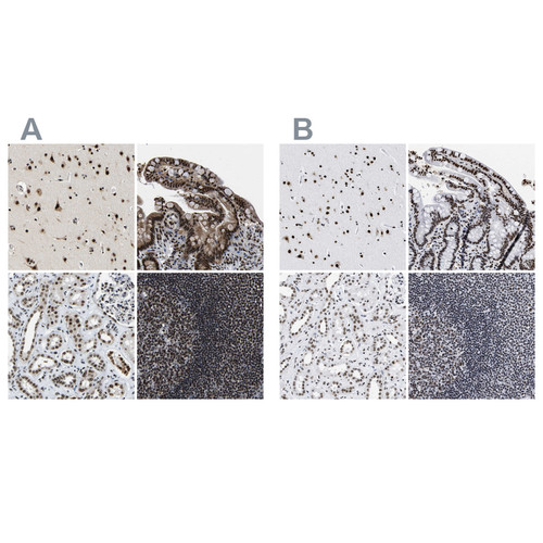 Immunohistochemical staining of human cerebral cortex, colon, kidney and lymph node using Anti-LUC7L3 antibody HPA018475 (A) shows similar protein distribution across tissues to independent antibody HPA018484 (B).