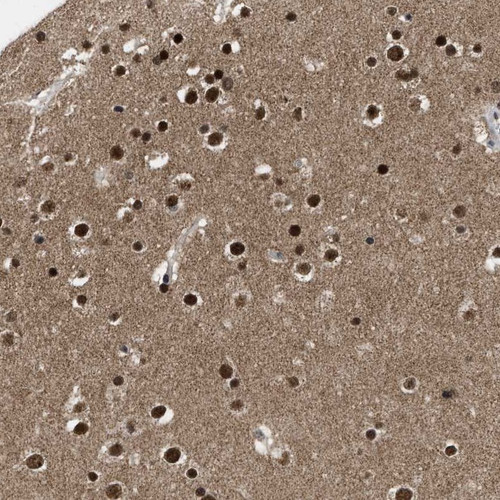 Immunohistochemical staining of human cerebral cortex shows strong nuclear positivity in neuronal cells and glial cells.
