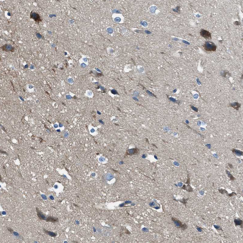 Immunohistochemical staining of human cerebral cortex shows moderate membranous positivity in neurons.