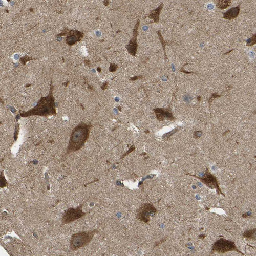 Immunohistochemical staining of human cerebral cortex shows strong granular cytoplasmic positivity in neuronal cells.