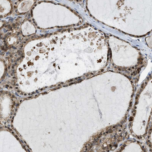 Immunohistochemical staining of human thyroid gland shows strong granular cytoplasmic positivity in glandular cells.