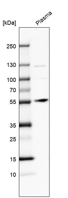 Western blot analysis in human plasma.