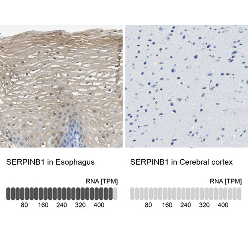 Immunohistochemistry analysis in human esophagus and cerebral cortex tissues using Anti-SERPINB1 antibody. Corresponding SERPINB1 RNA-seq data are presented for the same tissues.