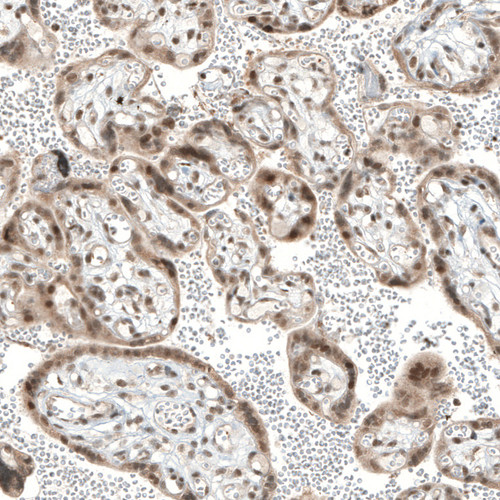 Immunohistochemical staining of human placenta shows moderate nuclear positivity in trophoblastic cells.