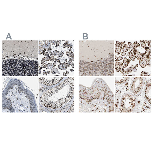Immunohistochemical staining of human cerebellum, placenta, skin and testis using Anti-ZC3HC1 antibody HPA019089 (A) shows similar protein distribution across tissues to independent antibody HPA024023 (B).