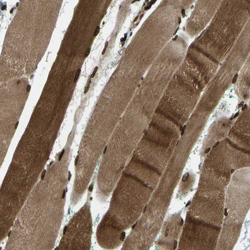 Immunohistochemical staining of human skeletal muscle shows strong cytoplasmic and nuclear membranous positivity in myocytes.