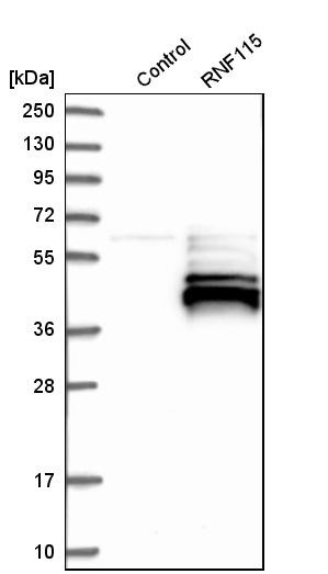 Western blot analysis in control (vector only transfected HEK293T lysate) and rNF115 over-expression lysate (Co-expressed with a C-terminal myc-DDK tag (~3.1 kDa) in mammalian HEK293T cells, LY415260).