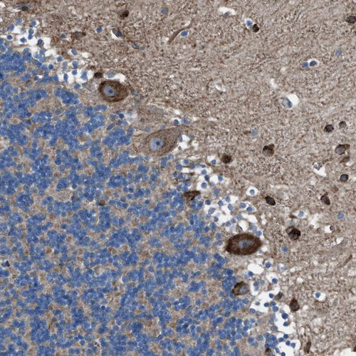 Immunohistochemical staining of human cerebellum shows strong cytoplasmic positivity in Purkinje cells.