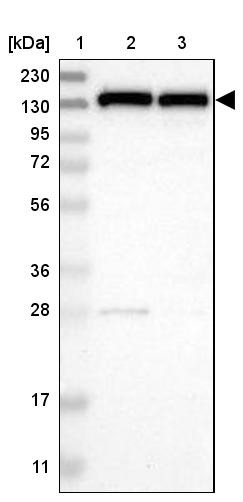 Lane 1: Marker [kDa] 230, 130, 95, 72, 56, 36, 28, 17, 11<br/>Lane 2: Human cell line RT-4<br/>Lane 3: Human cell line U-251MG sp