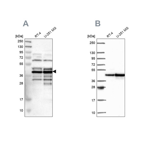 Western blot analysis using Anti-SLBP antibody HPA019254 (A) shows similar pattern to independent antibody HPA061670 (B).