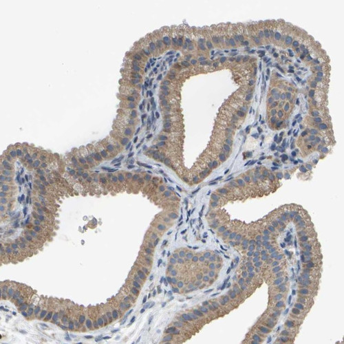 Immunohistochemical staining of human gallbladder shows moderate cytoplasmic positivity in glandular cells.