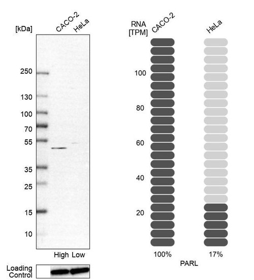 Western blot analysis in human cell line CACO-2 and human cell line HeLa.