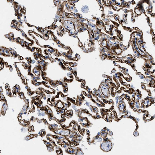 Immunohistochemical staining of human lung shows strong membranous positivity in pneumocytes.
