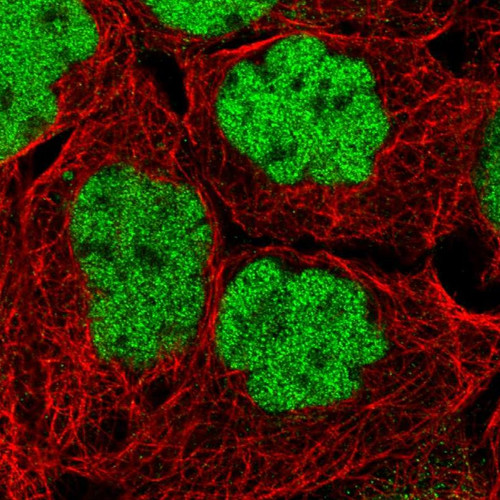 Immunofluorescent staining of human cell line A-431 shows localization to nucleoplasm.