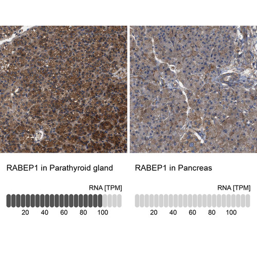 Immunohistochemistry analysis in human parathyroid gland and pancreas tissues using Anti-RABEP1 antibody. Corresponding RABEP1 RNA-seq data are presented for the same tissues.