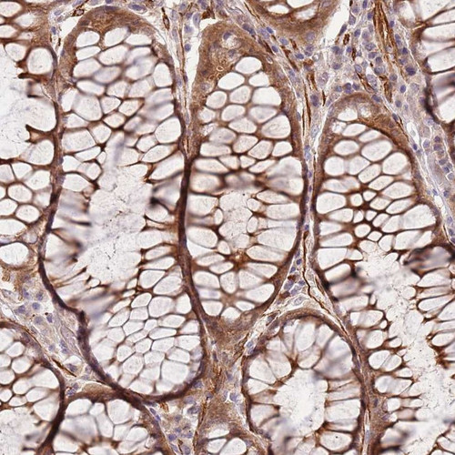 Immunohistochemical staining of human rectum shows moderate cytoplasmic positivity in glandular cells.