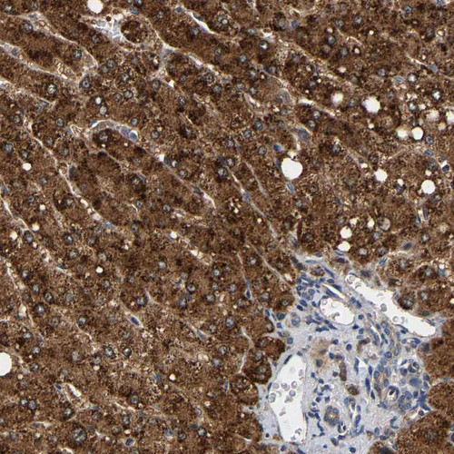 Immunohistochemical staining of human liver shows strong cytoplasmic positivity in hepatocytes.