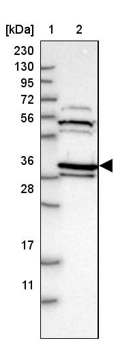 Lane 1: Marker [kDa] 230, 130, 95, 72, 56, 36, 28, 17, 11<br/>Lane 2: Human cell line RT-4