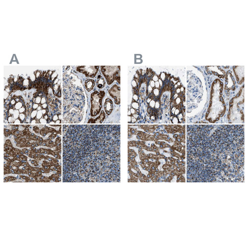 Immunohistochemical staining of human colon, kidney, liver and lymph node using Anti-MDH2 antibody HPA019714 (A) shows similar protein distribution across tissues to independent antibody HPA019716 (B).