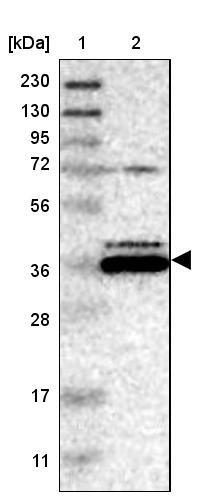 Lane 1: Marker [kDa] 230, 130, 95, 72, 56, 36, 28, 17, 11<br/>Lane 2: Human cell line RT-4