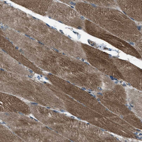 Immunohistochemical staining of human skeletal muscle shows distinct cytoplasmic positivity.