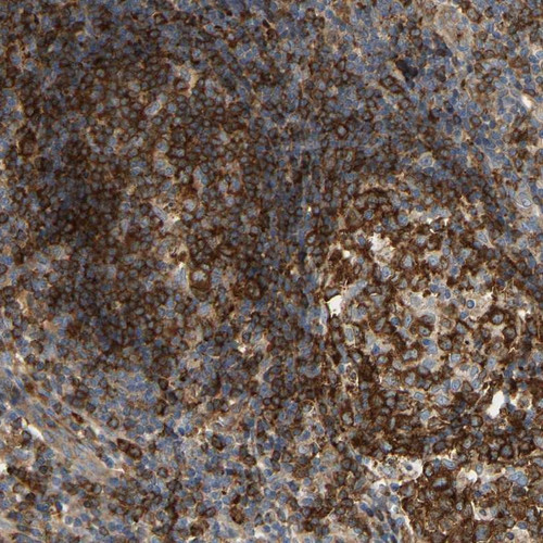 Immunohistochemical staining of human appendix shows strong cytoplasmic positivity in lymphoid tissue.