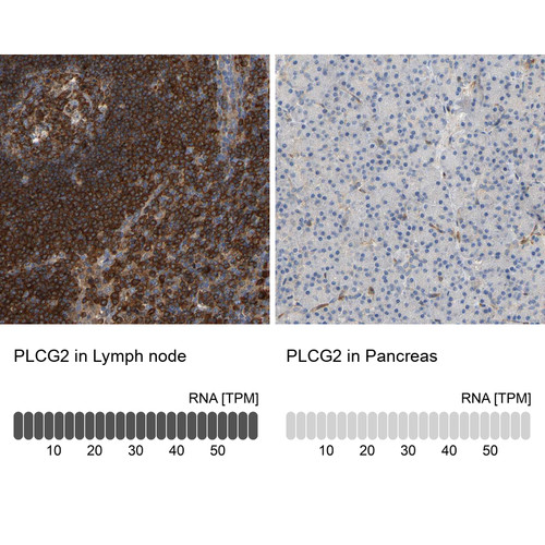 Immunohistochemistry analysis in human lymph node and pancreas tissues using HPA020100 antibody. Corresponding PLCG2 RNA-seq data are presented for the same tissues. Immunohistochemistry analysis in human lymph node and pancreas tissues using HPA020100 antibody. Corresponding PLCG2 RNA-seq data are presented for the same tissues.