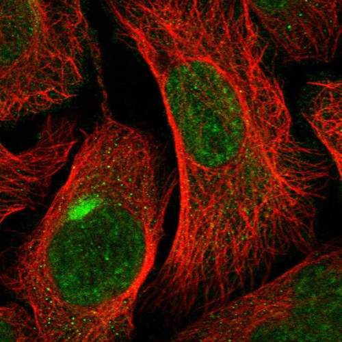 Immunofluorescent staining of human cell line U-2 OS shows localization to nuclear speckles & aggresome.