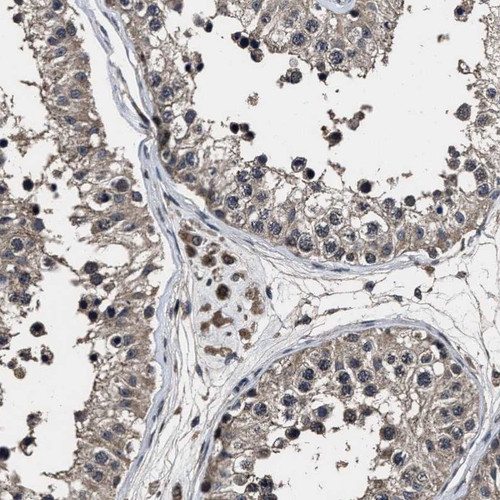 Immunohistochemical staining of human testis shows cytoplasmic and nuclear positivity in cells in seminiferous ducts and Leydig cells.