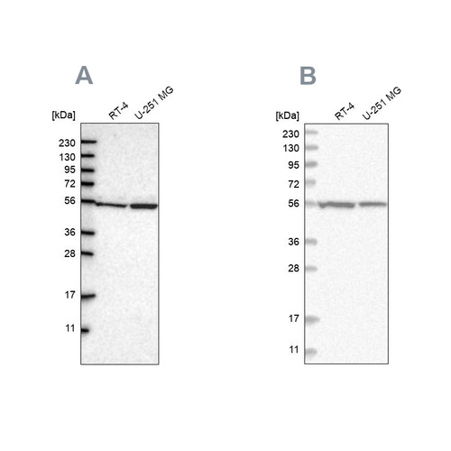 Western blot analysis using Anti-DARS antibody HPA020451 (A) shows similar pattern to independent antibody HPA029804 (B).
