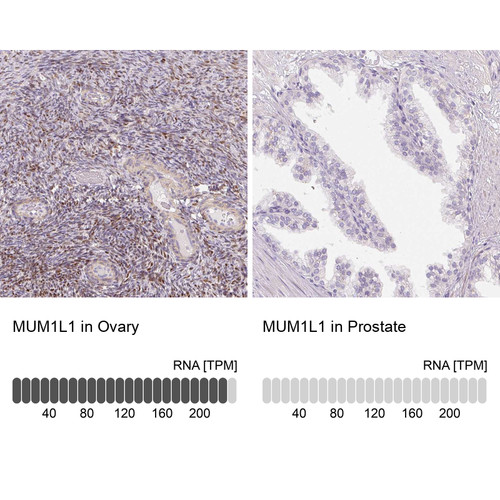 Immunohistochemistry analysis in human ovary and prostate tissues using Anti-MUM1L1 antibody. Corresponding MUM1L1 RNA-seq data are presented for the same tissues.