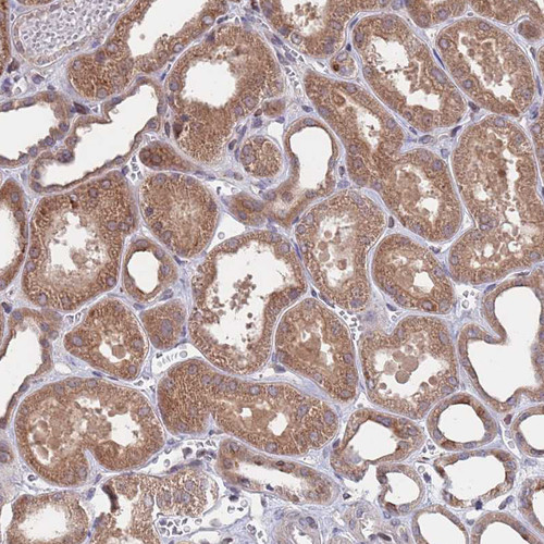 Immunohistochemical staining of human kidney shows moderate cytoplasmic positivity in cells in tubules.