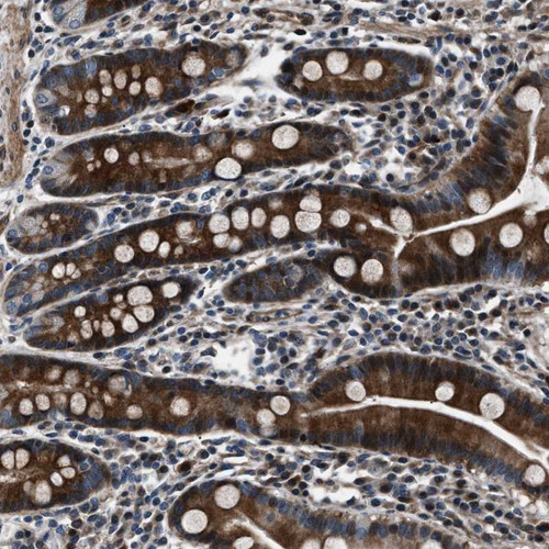 Immunohistochemical staining of human duodenum shows strong cytoplasmic positivity in glandular cells.