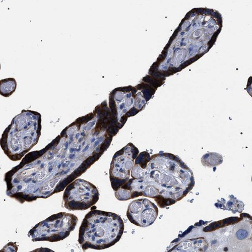 Immunohistochemical staining of human placenta shows strong cytoplasmic positivity in trophoblastic cells.