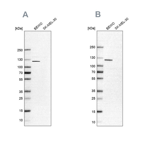 Western blot analysis using Anti-NLRP2 antibody HPA020765 (A) shows similar pattern to independent antibody HPA021183 (B).
