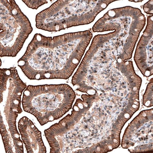 Immunohistochemical staining of human duodenum shows both membranous and nuclear positivity in glandular cells.