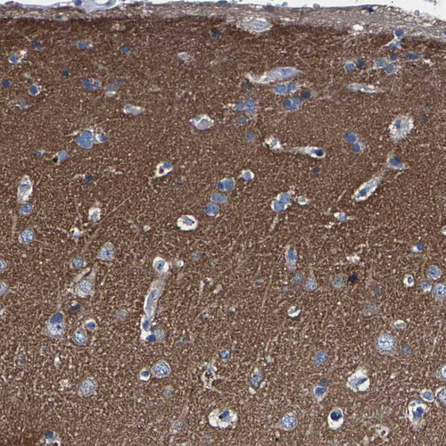Immunohistochemical staining of human cerebral cortex shows strong positivity in neuropil.