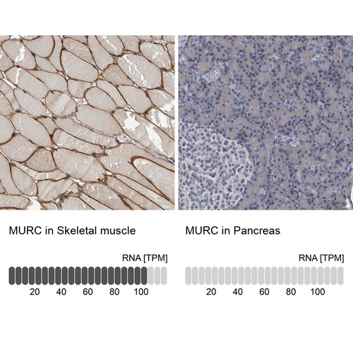 Immunohistochemistry analysis in human skeletal muscle and pancreas tissues using Anti-MURC antibody. Corresponding MURC RNA-seq data are presented for the same tissues.