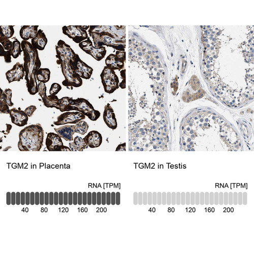 Immunohistochemistry analysis in human placenta and testis tissues using HPA021019 antibody. Corresponding TGM2 RNA-seq data are presented for the same tissues.