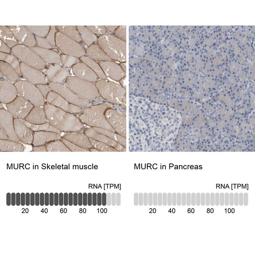 Immunohistochemistry analysis in human skeletal muscle and liver tissues using Anti-MURC antibody. Corresponding MURC RNA-seq data are presented for the same tissues.