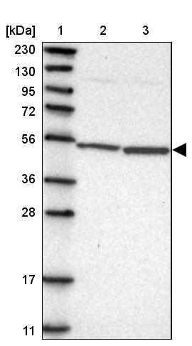 Lane 1: Marker [kDa] 230, 130, 95, 72, 56, 36, 28, 17, 11<br/>Lane 2: Human cell line RT-4<br/>Lane 3: Human cell line U-251MG sp