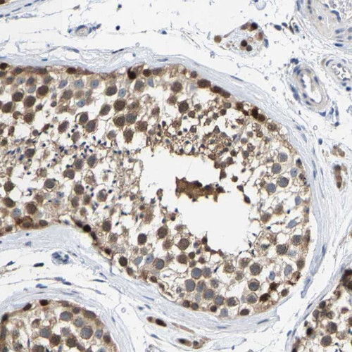 Immunohistochemical staining of human testis shows distinct positivity in cells of the seminiferus ducts.