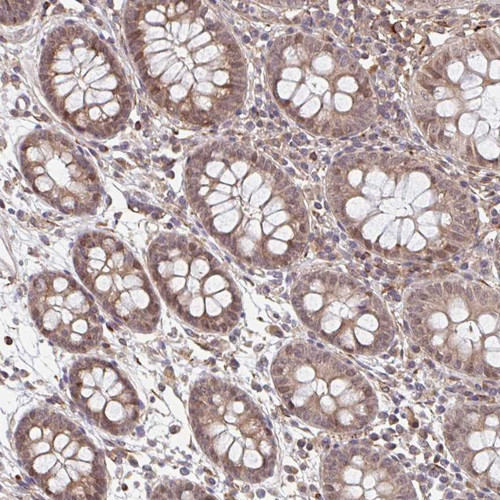 Immunohistochemical staining of human colon shows moderate cytoplasmic and nuclear positivity in glandular cells.