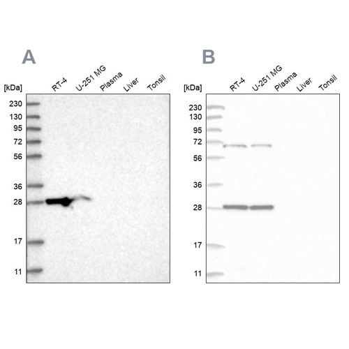 Western blot analysis using Anti-MRPL10 antibody HPA021234 (A) shows similar pattern to independent antibody HPA029885 (B).