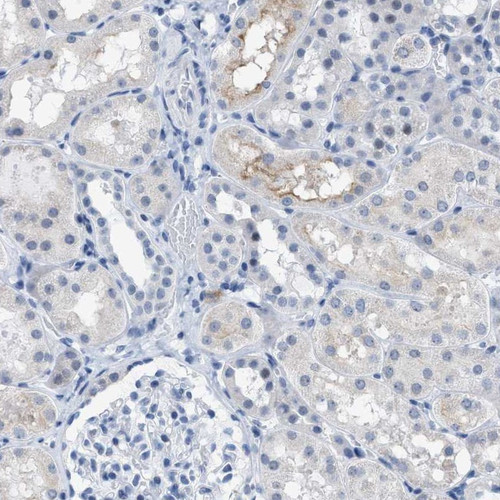 Immunohistochemical staining of human kidney shows weak cytoplasmic positivity in cells in tubules.