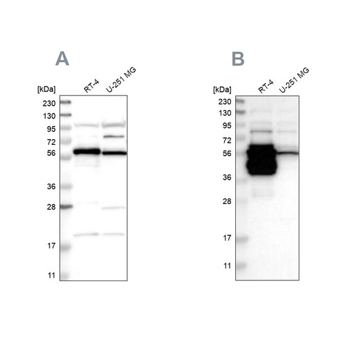 Western blot analysis using Anti-BAIAP2L1 antibody HPA021257 (A) shows similar pattern to independent antibody HPA019484 (B).