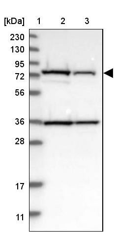 Lane 1: Marker [kDa] 230, 130, 95, 72, 56, 36, 28, 17, 11<br/>Lane 2: Human cell line RT-4<br/>Lane 3: Human cell line U-251MG sp